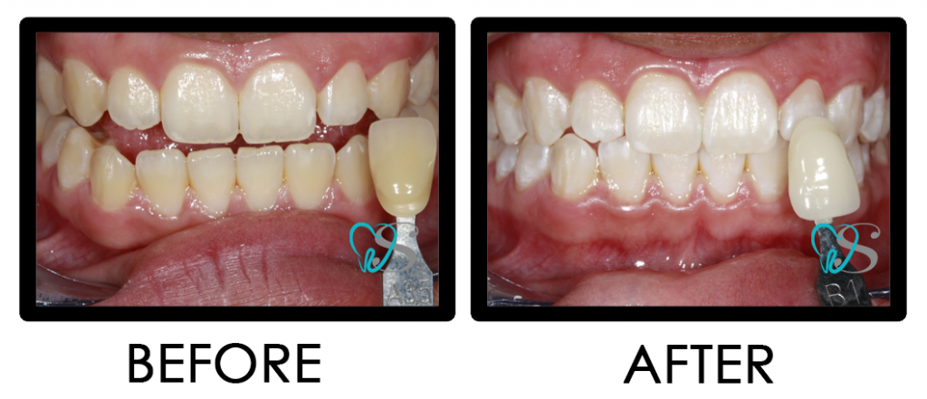 Our Dental Services Winning Smile Dental Clinic Makati