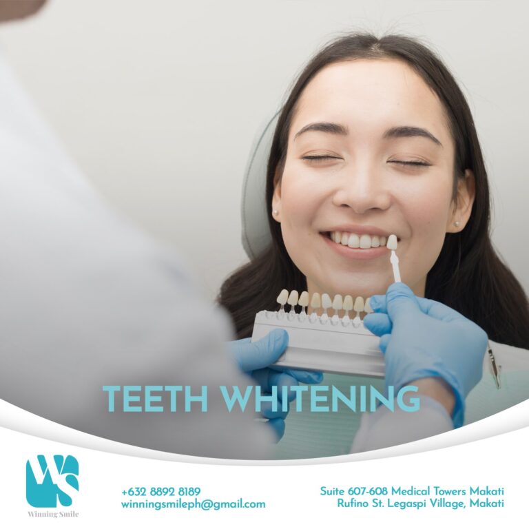 Teeth Whitening Costs in the Philippines Winning Smile Dental Clinic